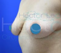 003-pexia-antes 003-pexia-antes