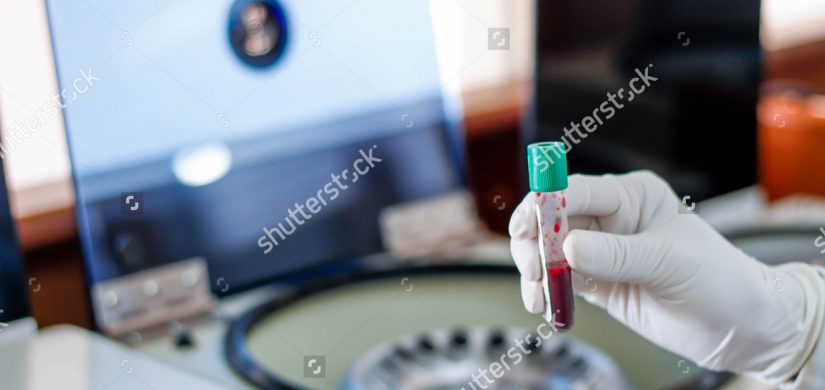 hand-holding-test-tube-blood-plasma-581785891 hand-holding-test-tube-blood-plasma-581785891
