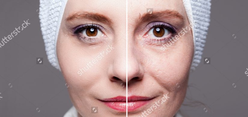 happy-woman-after-beauty-treatment-beforeafter-611632718 happy-woman-after-beauty-treatment-beforeafter-611632718
