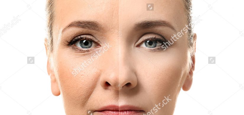 mature-woman-face-before-after-cosmetic-570340453 mature-woman-face-before-after-cosmetic-570340453