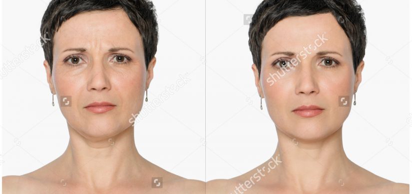 woman-without-aging-singes-double-chin-309662807
